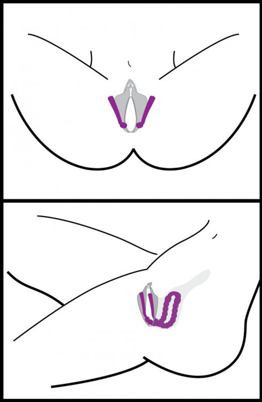 Oral Enhancing Hands Free Labia Spreader in Pink Medical Themed